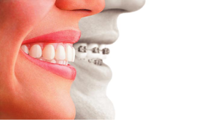 Invisalign Braces: Dentists and Dental Services near Marco Island FL